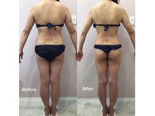 ソア(Soa.)の雰囲気（本気で痩せたい方へ。結果重視の痩身）