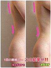 ルミネ(Lumine)/気になる背中やウエストラインに