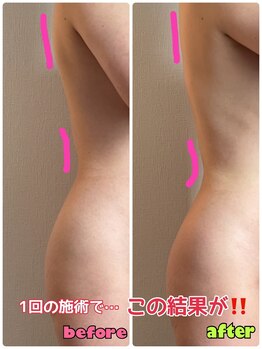 ルミネ(Lumine)/気になる背中やウエストラインに
