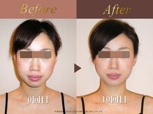 オーシャン(Ocean)/全身美容矯正120分/週1回×10回