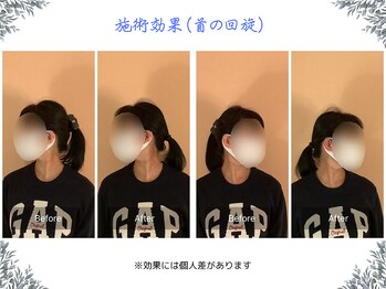 ボディ リセット アンド デザイン(Body Reset & Design)/【施術例】ビフォーアフター