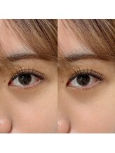 ファミーユ 太田(Fameu)/デザインキープラッシュ