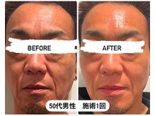 ビーアンドアイ シズオカテン レディース(B＆I SHIZUOKA)/50代男性　エアーポテンツァ1回