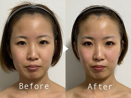 ベルシー(BELTHY)の写真