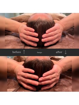 サンゴ(Sango)/ドライヘッド小顔矯正