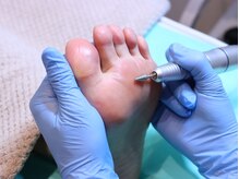 巻き爪補正店 大分店