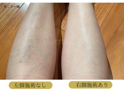 エルビア エステ ドゥ パリ(Elevia Esthe de Paris)の写真