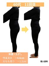 ヨサパーク ユア(YOSAPARK Yua)/11回目の施術結果