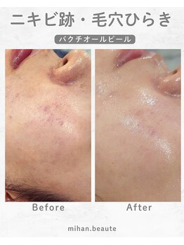 ミハン ボーテ(mihan.beaute)/