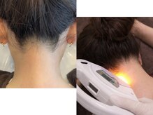 ハナサクラ 心斎橋(HANASAKURA)