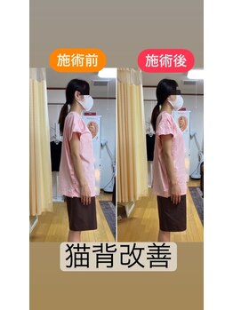 ホジュン鍼灸整体院/猫背改善