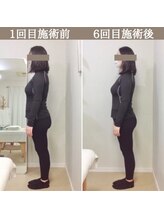 シェア 人形町店(Chare)/【小顔・骨盤矯正・О脚・整体】