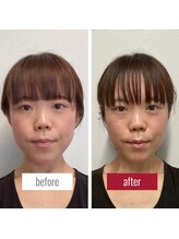 サロンチオリ 烏丸(Salon Chiori)/《30代》歪み左右差小顔矯正