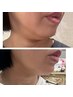 【脂肪に即効レモンボトル】たるみ&フェイスラインに！