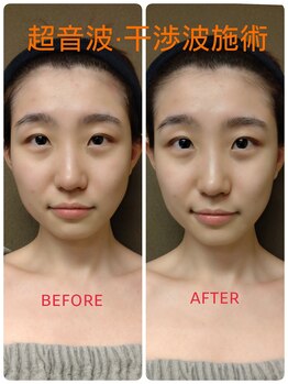 ドクタージェーナ(Dr.Jena)/お客様before/after