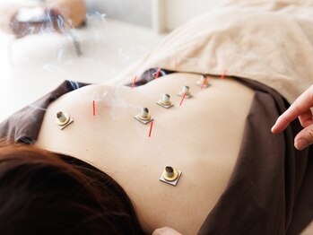 プライムライフ(prime-life)/鍼とお灸の相乗効果を♪