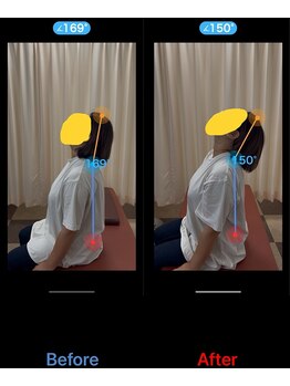 うらら整骨院/しっかり上が向けるように！！