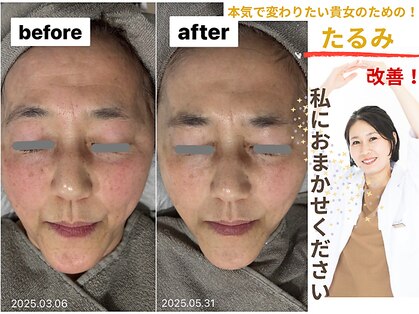 ココン(cocon)の写真