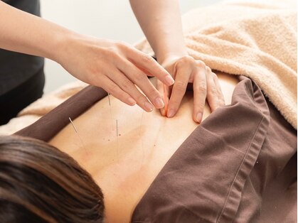 つつじが丘整骨院鍼灸マッサージ院の写真