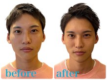 テテドベベヘッドスパバイアンレーヴ(tete de bebe headspa by unreve)/ヘッドスパ　before→after