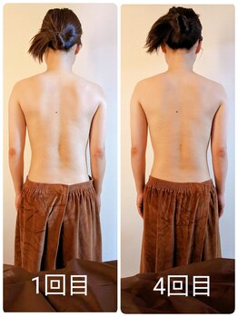 エル(eL)/20代前半のお客様