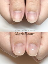 マリーロール 淀屋橋本店(Marie Laure)/自爪育成/深爪矯正/ネイルケア