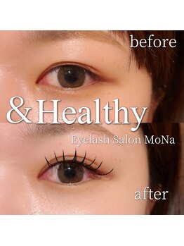 モナ(MoNa)/アンドヘルシー(&healthy)