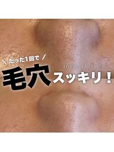 ジェノール 2nd beauty studio 姫路駅前店(JNOEL)/毛穴悩みもスッキリ解決！