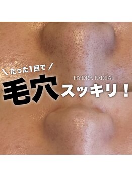 ジェノール 2nd beauty studio 姫路駅前店(JNOEL)/毛穴悩みもスッキリ解決！