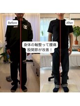 はやと整体院/50代男性（腰痛・股関節の痛み）