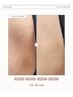 韓国最新黒ずみケア！THE MELANIN【Vライン】￥52,500 (30分)
