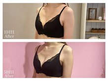 ククナ(KUKUNA)/*バストアップマッサージ*