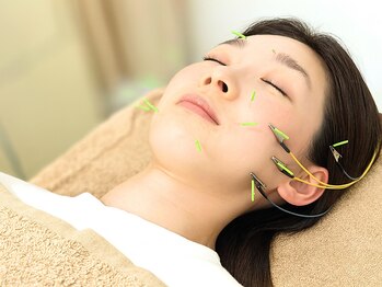 ホシ治療院の写真/【肌質改善/小顔】電気美容鍼×ドライヘッドスパで、貴女の理想をカタチにします！[リフトアップ/小顔◎]