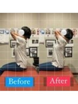 ナオル整体 宮崎院(NAORU整体)/50代女性施術事例【猫背改善】