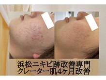 アエオボンヌール(A.E.O BONHEUR)の雰囲気（お肌のデトックスでニキビ・毛穴を根本改善）