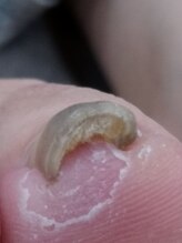 フットケアサロン ラビフット(Rabbi foot)/とても巻いていてもOKです！