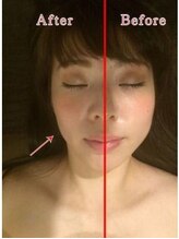 グレースフィオーレ 町田店(gracefiore)/お客様のビフォーアフターその4