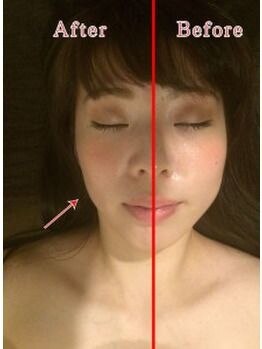 グレースフィオーレ 町田店(gracefiore)/お客様のビフォーアフターその4