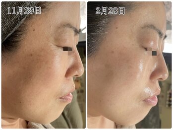 アイルーム(i.room)/