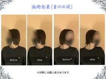 ボディ リセット アンド デザイン(Body Reset & Design)/【施術例】ビフォーアフター