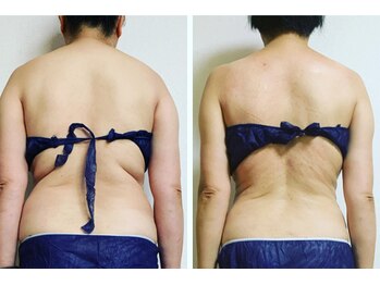 アンリ(Anli)/9月1日オープン♪ワクワク