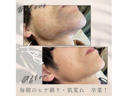 ルアナラウンジ(Luana Lounge)の写真