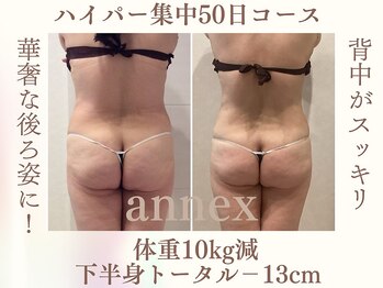 フォーユー マシバメディカル(For You Mashiba Medical)/２ヶ月集中プラン　５０代