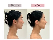 フロリール アザブジュウバン(FlorirAzabujuban)/小顔フェイシャル×リフトヘッド