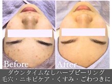 エステティック シャララ(Sha la la)の雰囲気（お客様お1人お1人にぴったりの商材を使用し施術致します）
