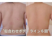 れふぇるん 足利店の雰囲気（ワキ肉・二の腕・背中！ボディラインも整える）