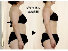 ディアメデル(Diamedel)/