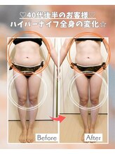 エステサロン 凛/１回の変化で結果が出るのが良い
