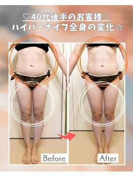 エステサロン 凛/1回の変化で結果が出るのが良い