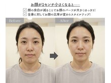 アジール 新潟市(agir)/1cmのサイズダウンで正面の変化